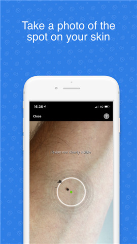 SkinVision无广告版app下载-SkinVision官网版app下载